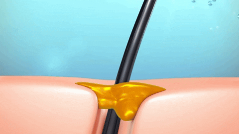 マイクロバブル